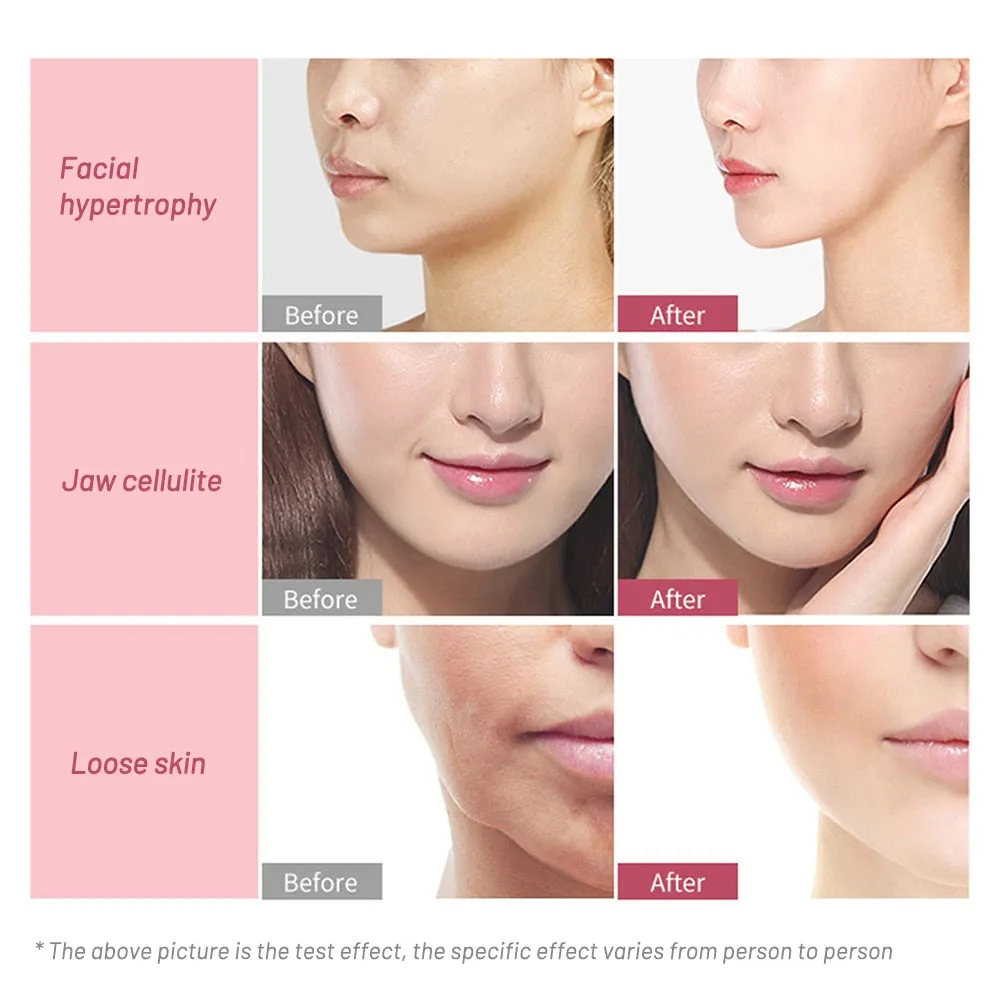 Face Lifting Roller